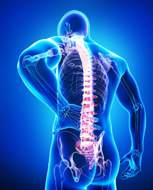 spine implant malpractice